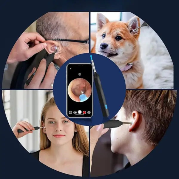 OtoScan® Portátil 👂🏼-Tecnología Avanzada Para Un Cuidado Auditivo🌟¡No uses mas copitos!🤨